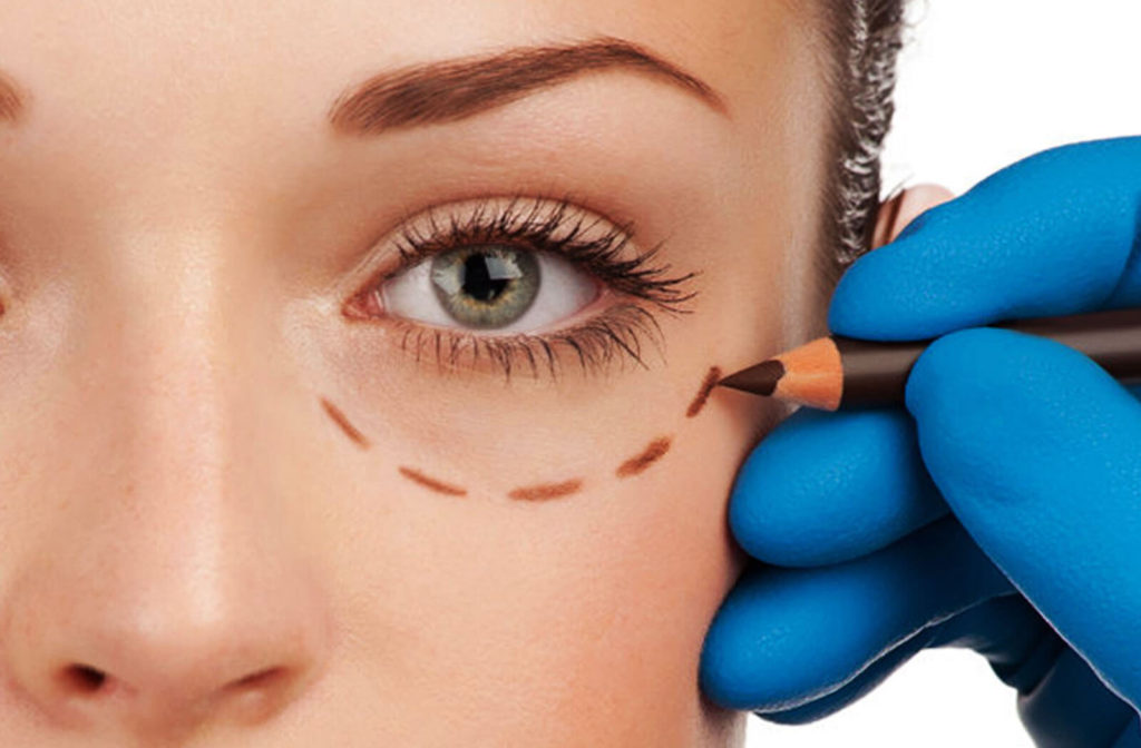 Косметология и пластическая хирургия против синяков под глазами